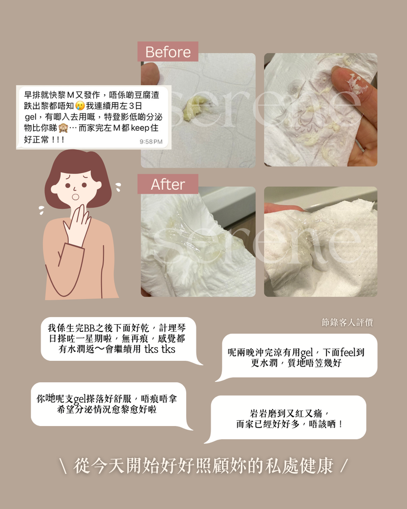 霉菌性陰道炎使用SERENE凝膠三天前後對比照片及四則真實用戶評價