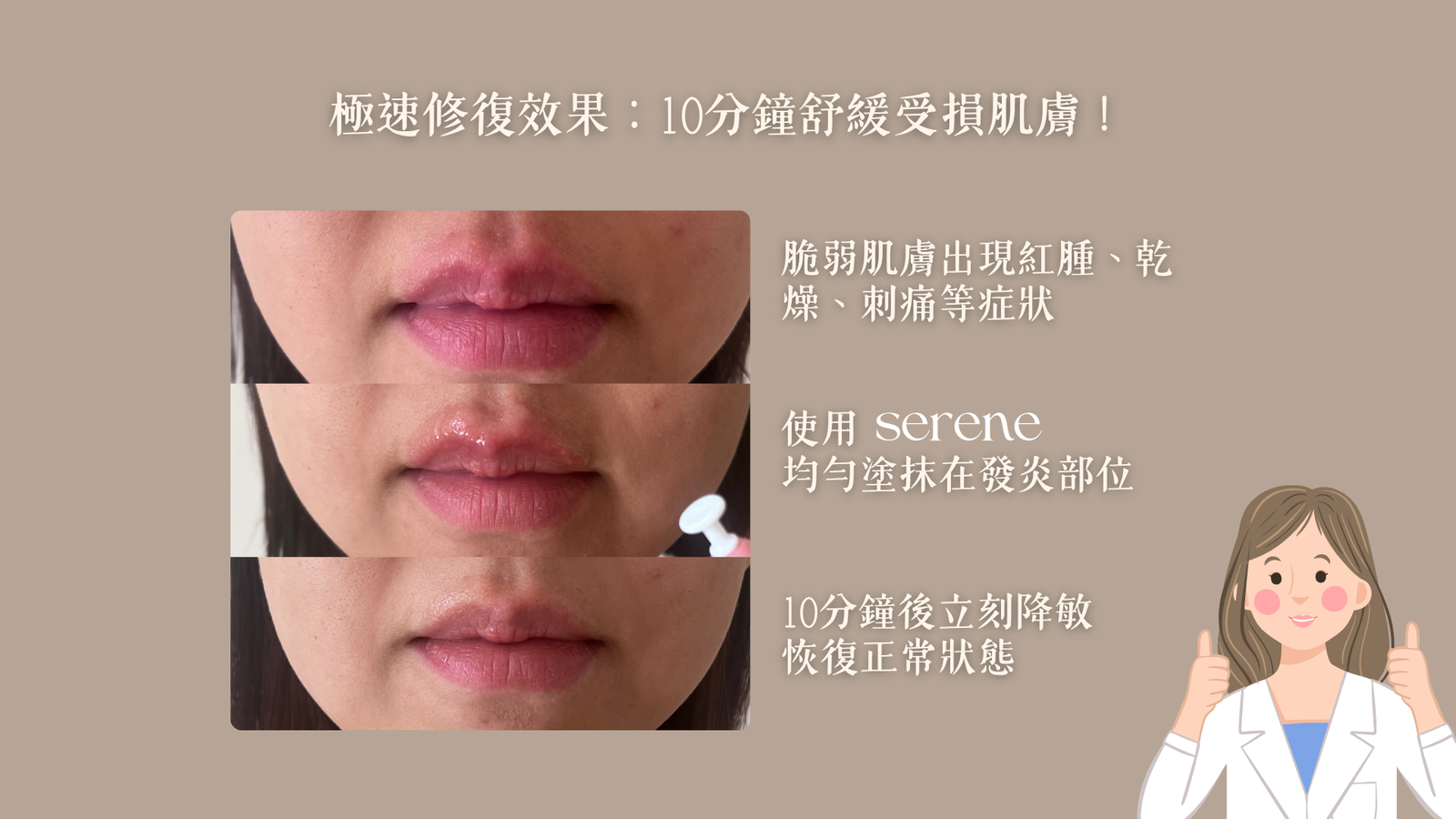 脆弱肌膚紅腫刺痛使用SERENE凝膠10分鐘前後對比實證照片